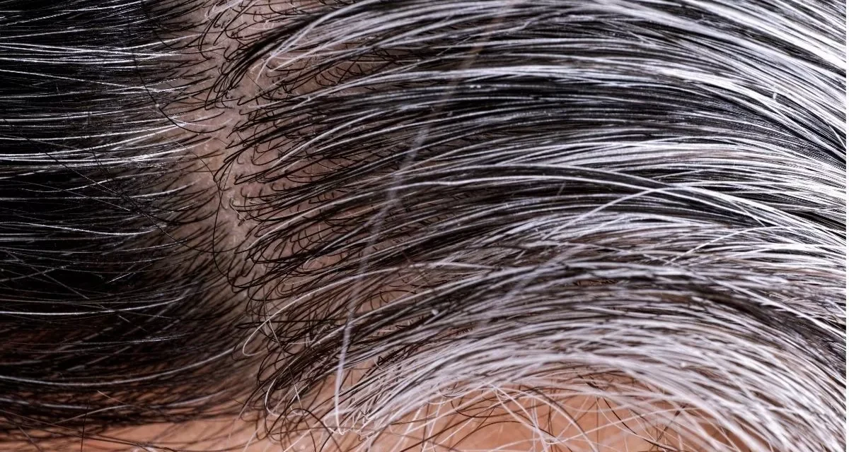 Stres Bikin Ubanan? Tenang, Masih Bisa Pulih Kok!