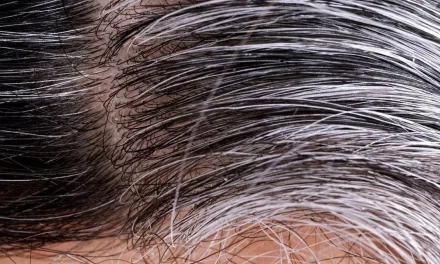 Stres Bikin Ubanan? Tenang, Masih Bisa Pulih Kok!