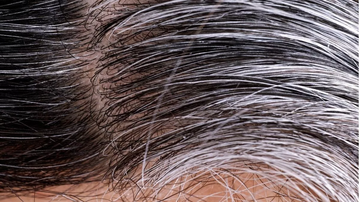 Stres Bikin Ubanan? Tenang, Masih Bisa Pulih Kok!